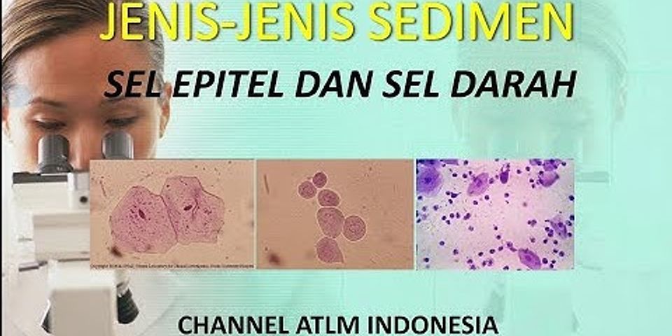 Perbedaan Leukosit Dan Eritrosit Pada Sedimen Urine