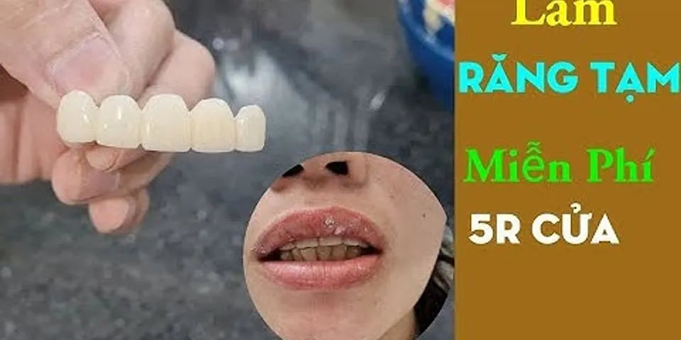 Cách làm răng giả tại Nha