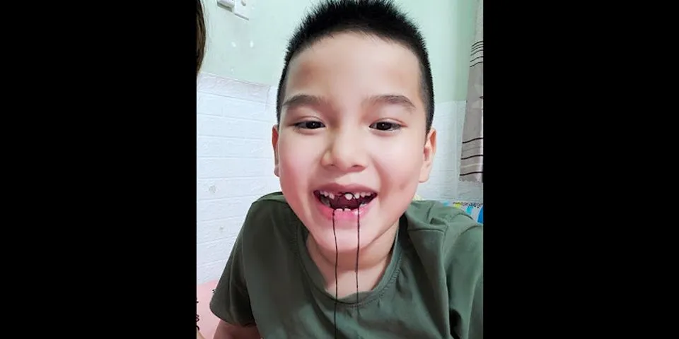 Cách nhổ răng tại nhà cho bé