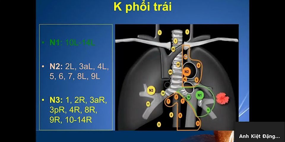 Chụp CT phổi giá bao nhiêu