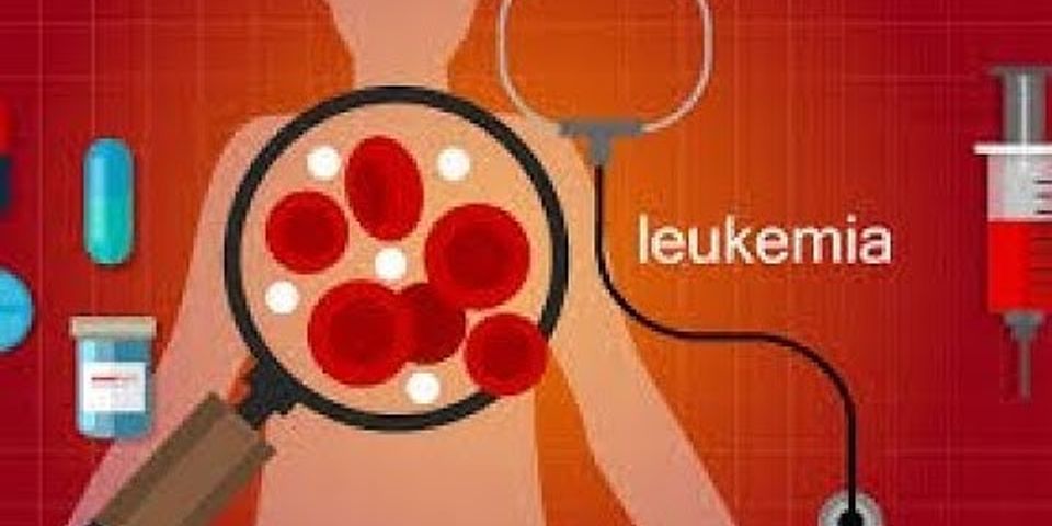 Perbedaan Dari Leukemia Dan Leukositosis