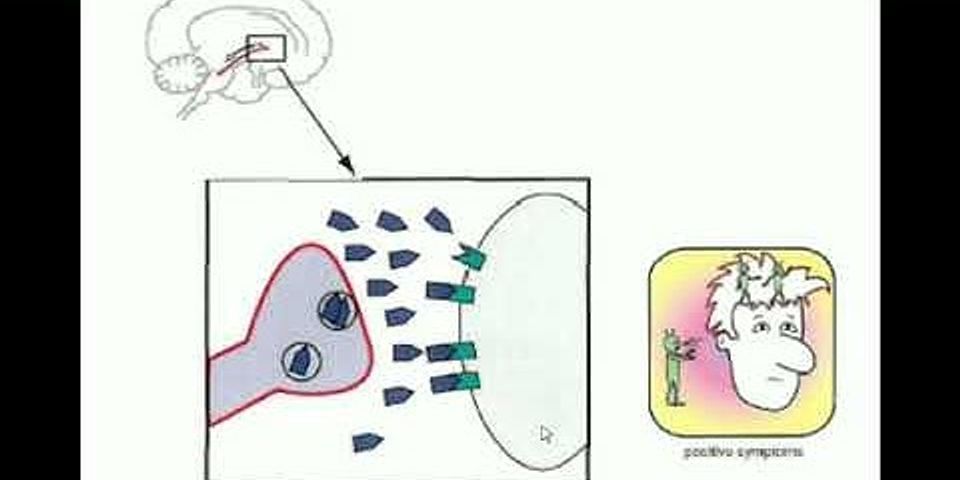 Perbedaan Psikosis Dan Non Psikosis