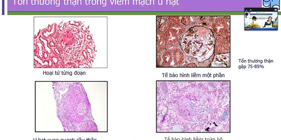 Vì sao lưới nội chất hạt phát triển mạnh ở tế bào bạch cầu