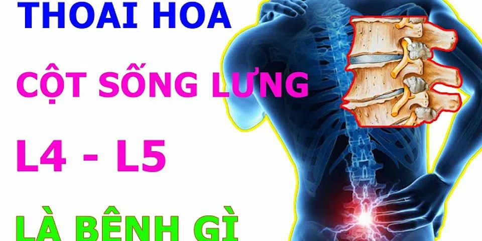 Vì sao thoái hóa cột sống lưng